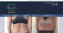 Desktop Screenshot of marylandlaserweightloss.com