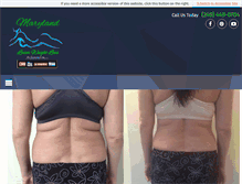Tablet Screenshot of marylandlaserweightloss.com